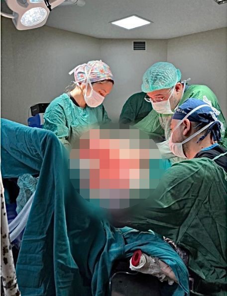 sivasta hastanin gogus duvarindaki 8 kiloluk tumor basariyla cikarildi 5 r19bLmLL