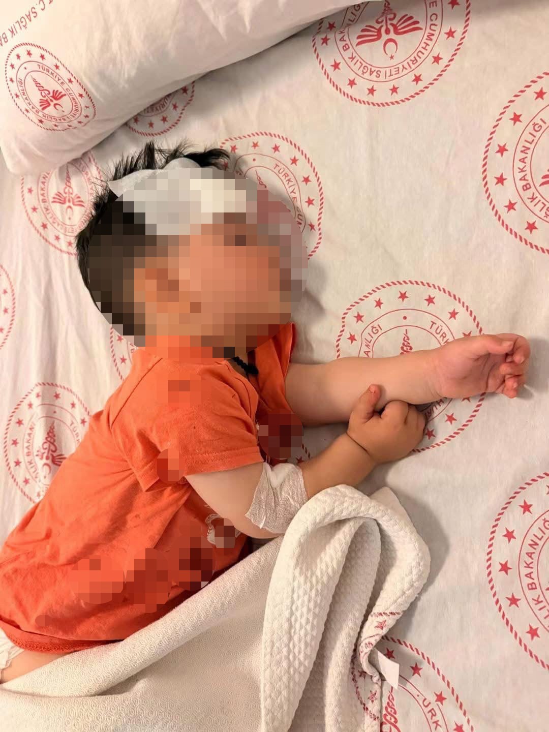 sokak kopeklerinin saldirdigi 1 bucuk yasindaki cocuk yaralandi 0 Sf5WRFtX