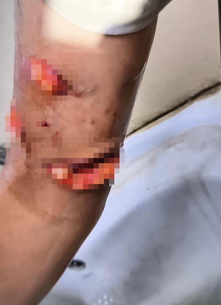 Suruç’ta başıboş köpekler 8 yaşındaki çocuğa saldırdı 6 suructa basibos kopekler 8 yasindaki cocuga saldirdi 2 79UWvSsp