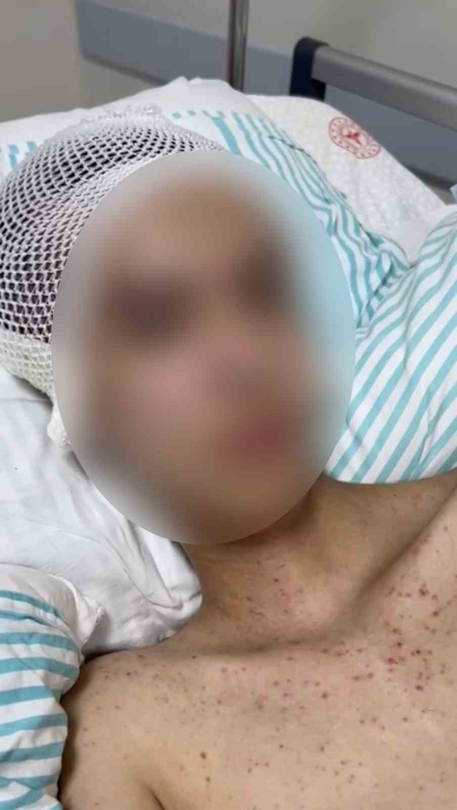 tacize direndigi iddiasiyla basindan vurulan cocuk felc kaldi 1 dLBPZQZw