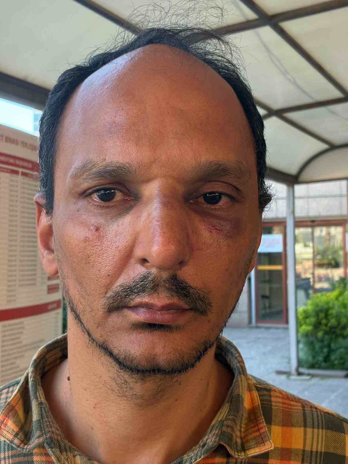 tomanin ustune cikip zarar veren saldirgan tutuklandi 1 859jTXLd