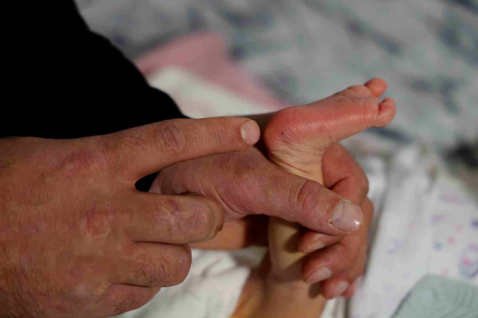 Topuk kanı çıkmazı: Bebeklerine kayyum atanması endişesiyle yaşıyorlar 6 topuk kani cikmazi bebeklerine kayyum atanmasi endisesiyle yasiyorlar 2 nfgYswmM