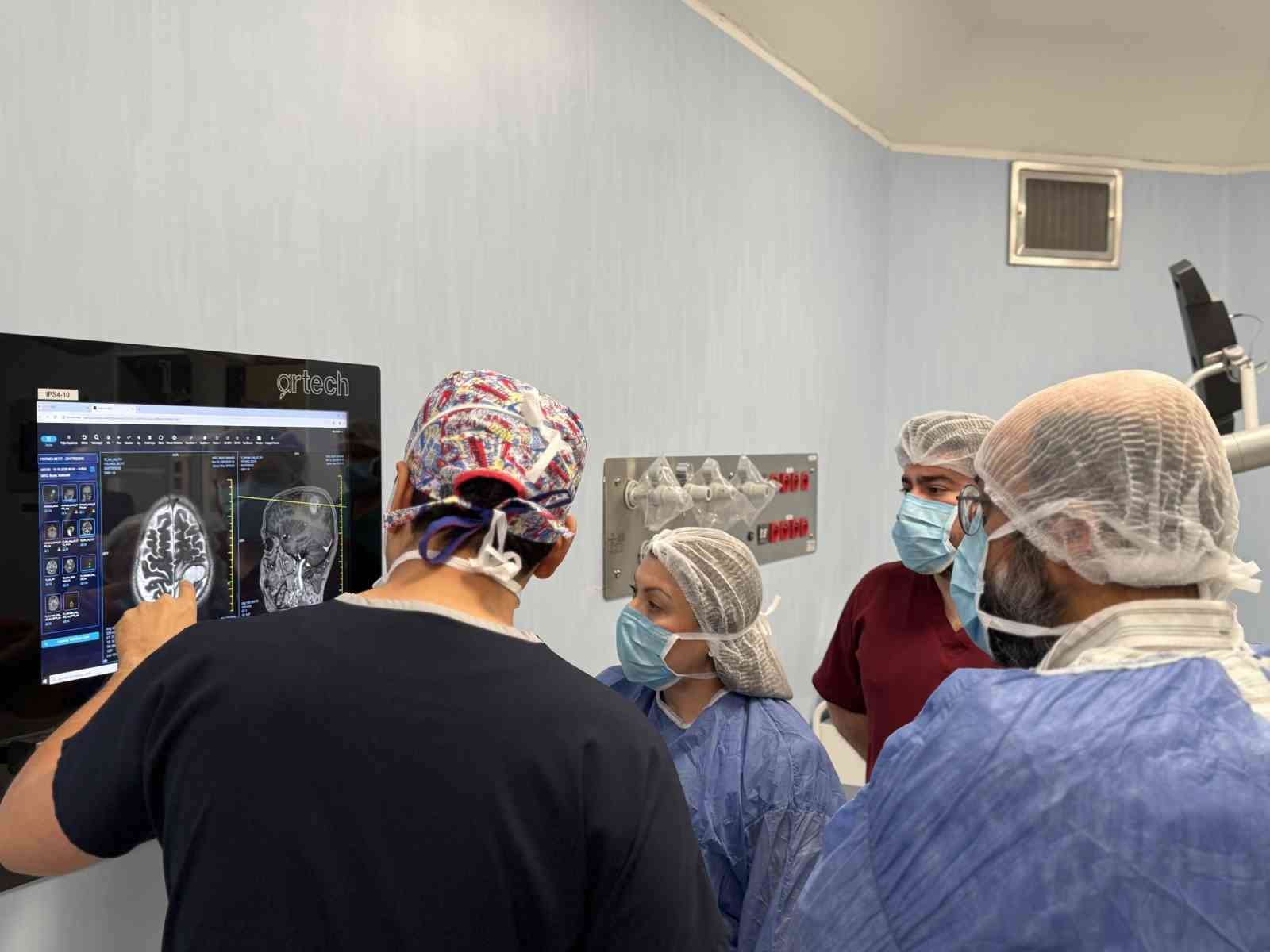 uyanik beyin ameliyatiyla tumor alindi 1 e1LXas2E