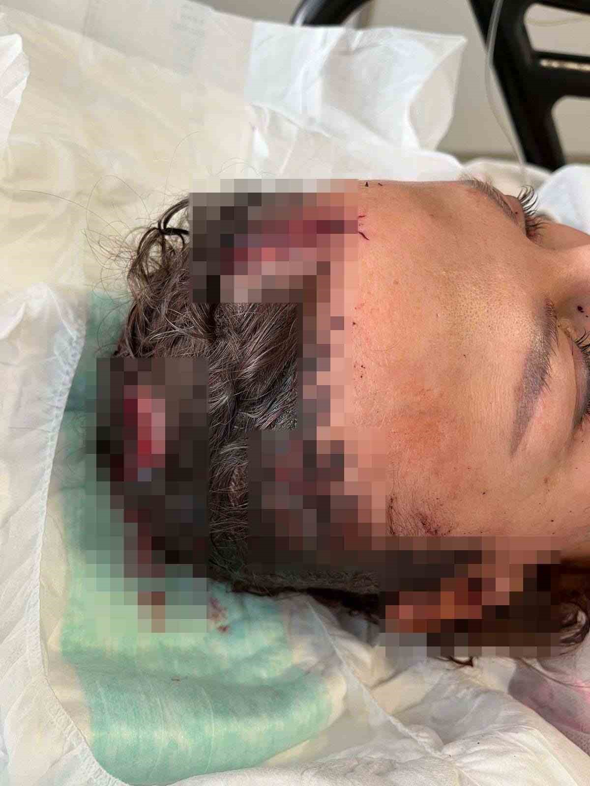 Uzaklaştırma kararı bulunan eşe sopalı saldırı davasında savcıdan 20 yıla kadar hapis talebi 12 uzaklastirma karari bulunan ese sopali saldiri davasinda savcidan 20 yila kadar hapis talebi 8 4Lwuf932