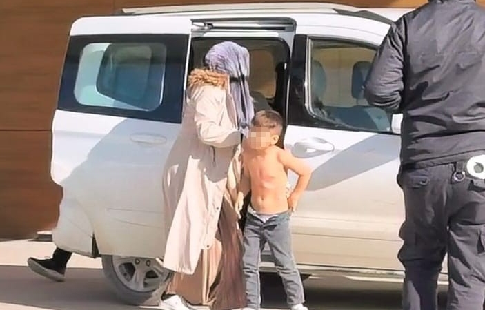 uzerine-kaynar-su-devrilen-cocuk-yaralandi-62mzqH7s.jpg