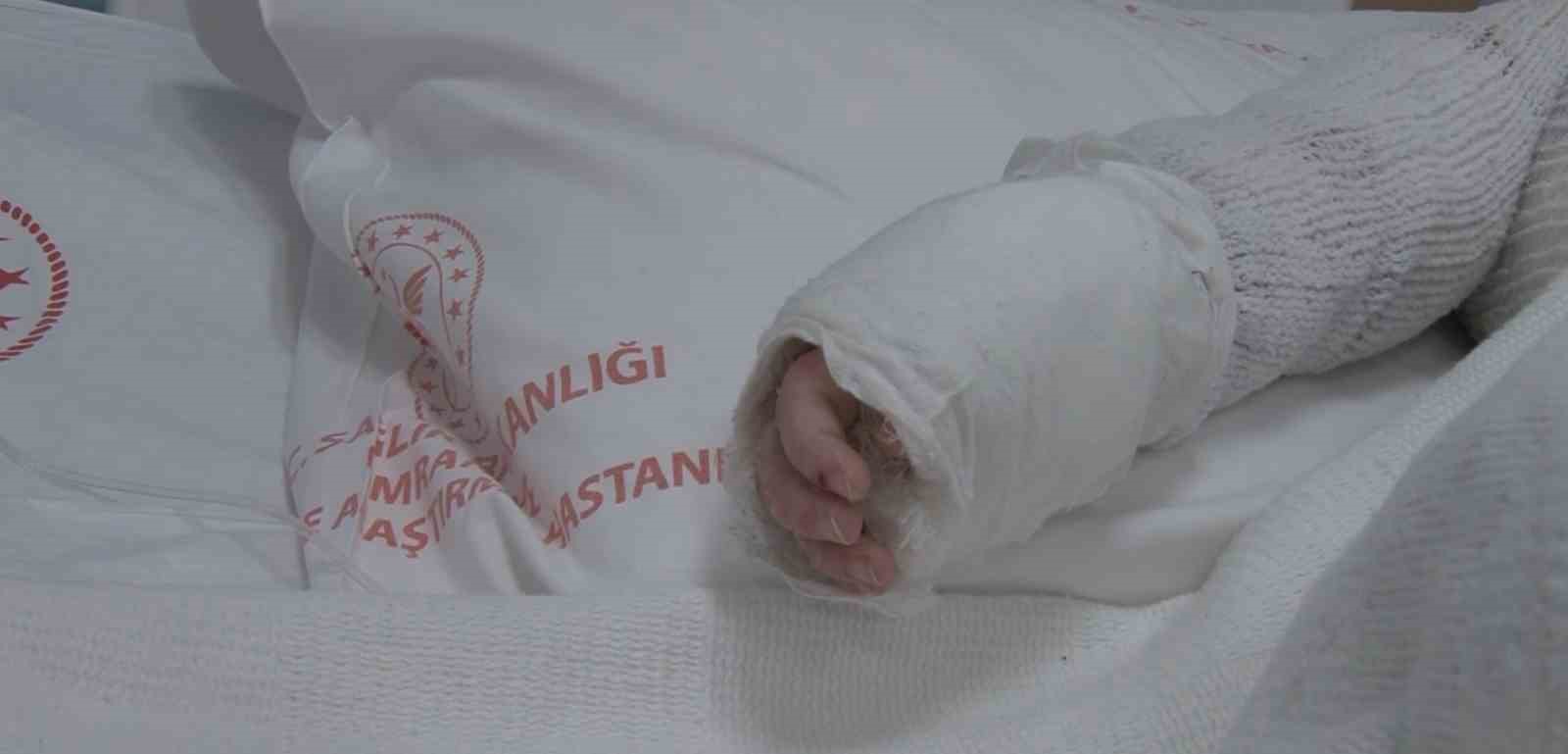 uzerine kaynar su dokulen bebegin vucudunun yuzde 27si yandi 0 nkH98m7l