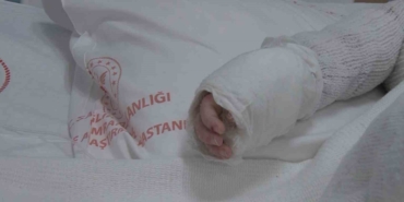 uzerine-kaynar-su-dokulen-bebegin-vucudunun-yuzde-27si-yandi-iyZPMEjy.jpg