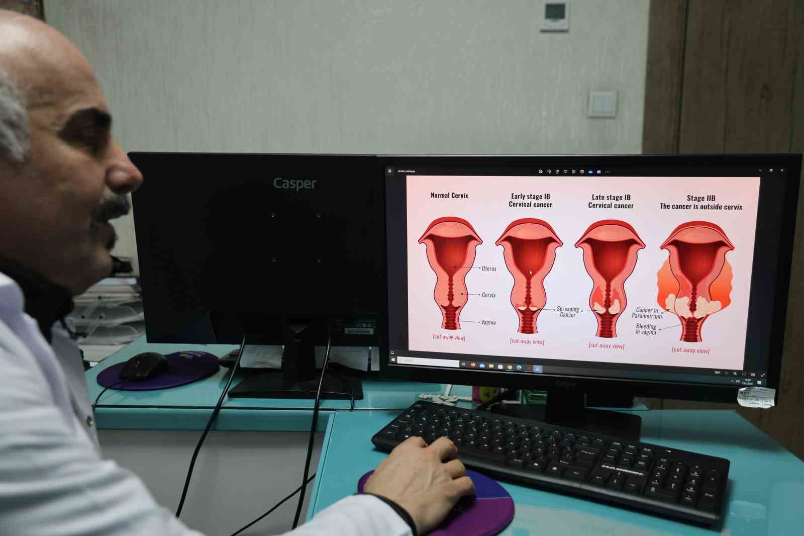 uzman dr diribas rahim agzi kanserinden olum ancak ihmal sonucu yasanabilir 1 zZ4Ua5D2