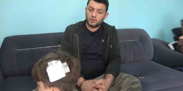 yalovadaki-komsu-kavgasinda-bu-kez-8-yasindaki-cocuga-tasli-saldiri-GbvaLWAu.jpg