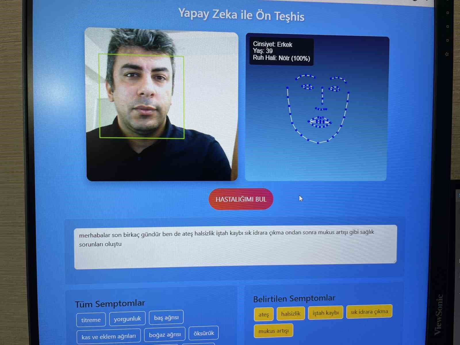 Yapay zeka destekli sanal doktor, sesi dinliyor, yüzü okuyor ve hastalığı buluyor 5 yapay zeka destekli sanal doktor sesi dinliyor yuzu okuyor ve hastaligi buluyor 1 z8w63Qgz