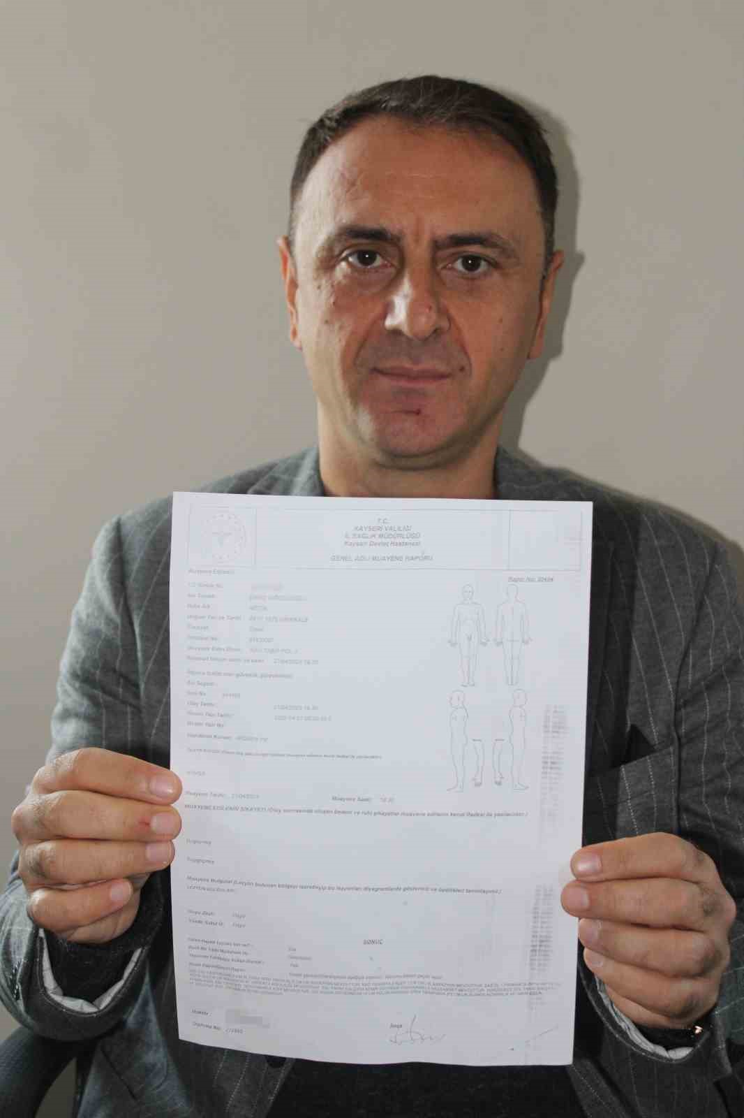 yenildikleri takimin futbolculari tarafindan darbedildiler 1 Qk4iW2zW